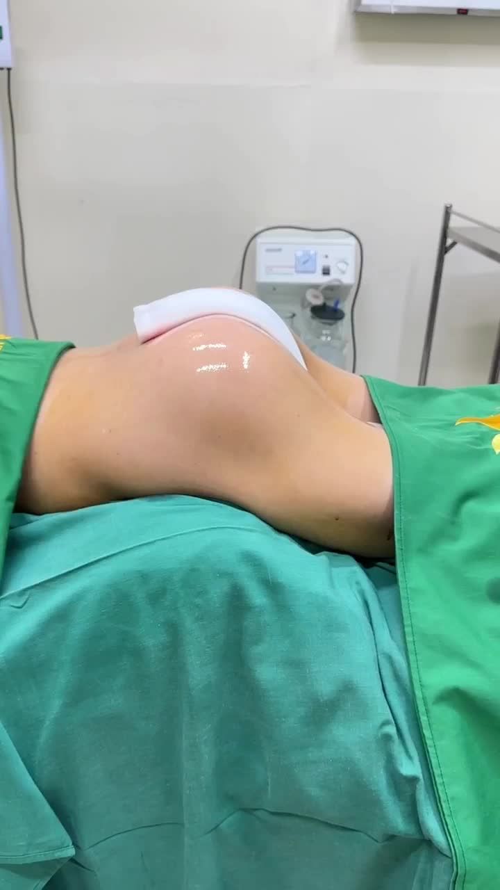 NÂNG MÔNG QUẢ TÁO