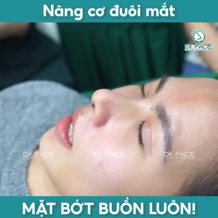 Làm xong COMBO MẮT + MŨI, mặt bỗng HẾT BUỒN luôn…
