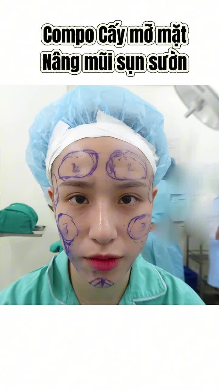 CA SĨ N LY XINH ĐẸP TRẺ TRUNG VỚI COMBO NÂNG MŨI VÀ CẤY MỠ MẶT