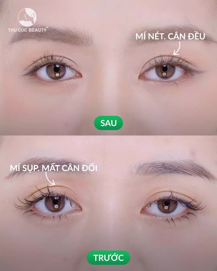 Kết quả sau 15 phút cắt