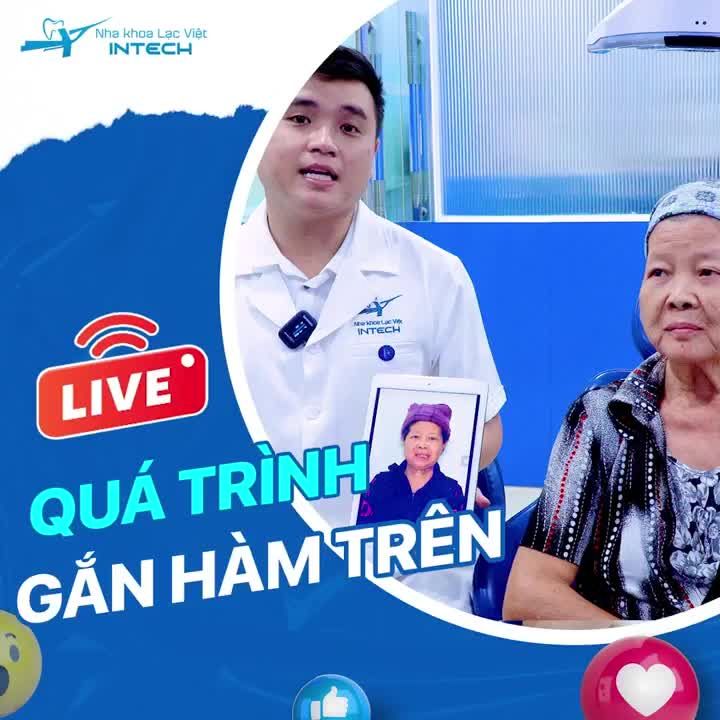 CẬN CẢNH QUÁ TRÌNH LẮP RĂNG TOÀN HÀM TRÊN