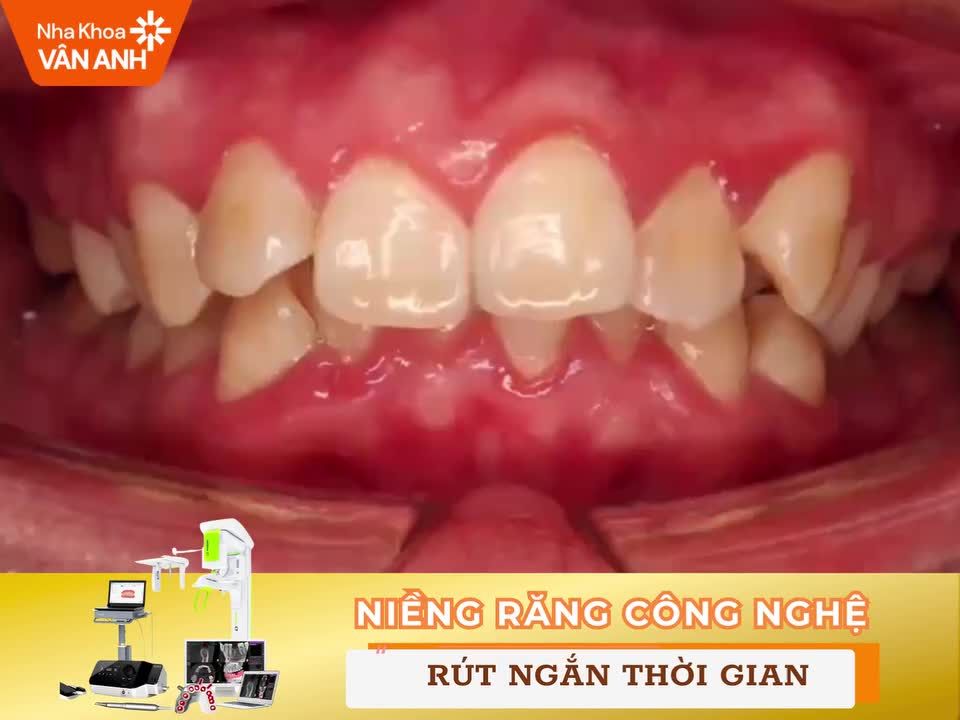 MUỐN ĐẸP TỰ NHIÊN - NHƯNG KHÔNG TỰ NHIÊN MÀ ĐẸP