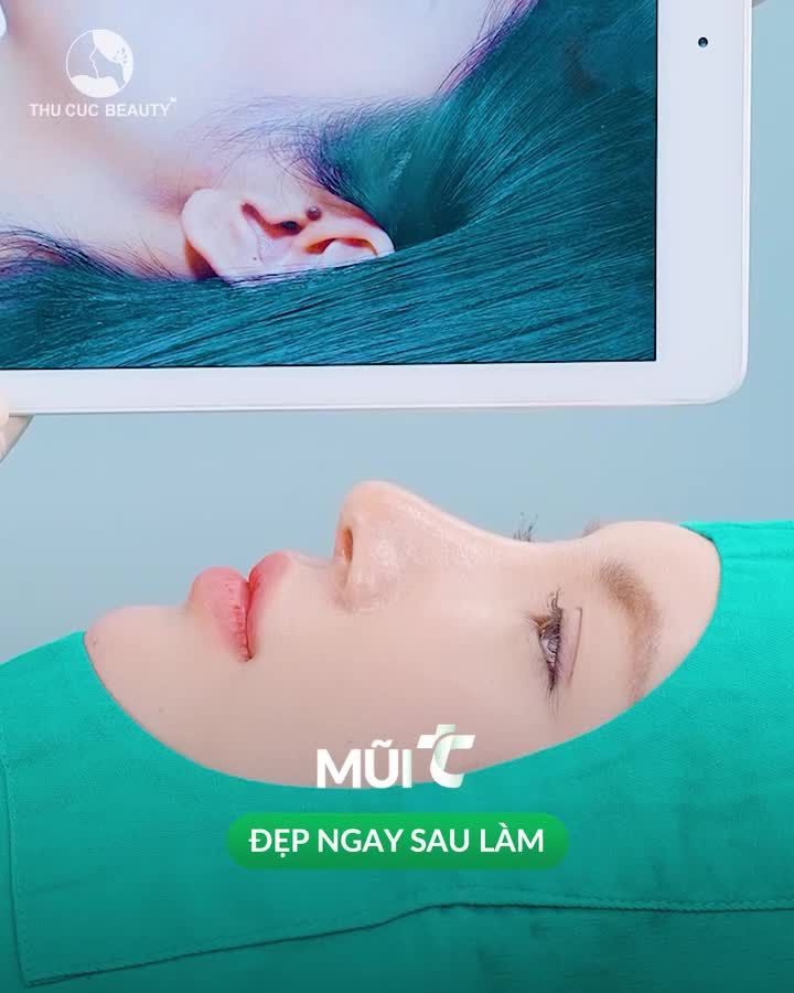 Tìm được phiên bản tốt nhất của bản thân hậu nâng mũi