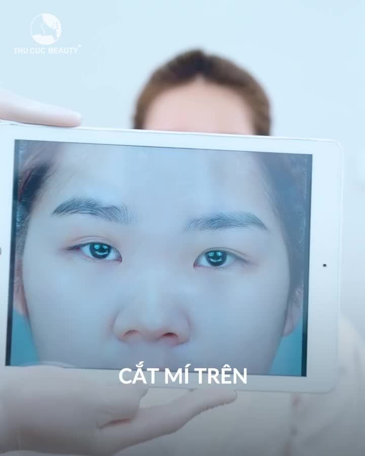 Chọn TC để có Giải pháp phù hợp cho đôi mắt của bạn