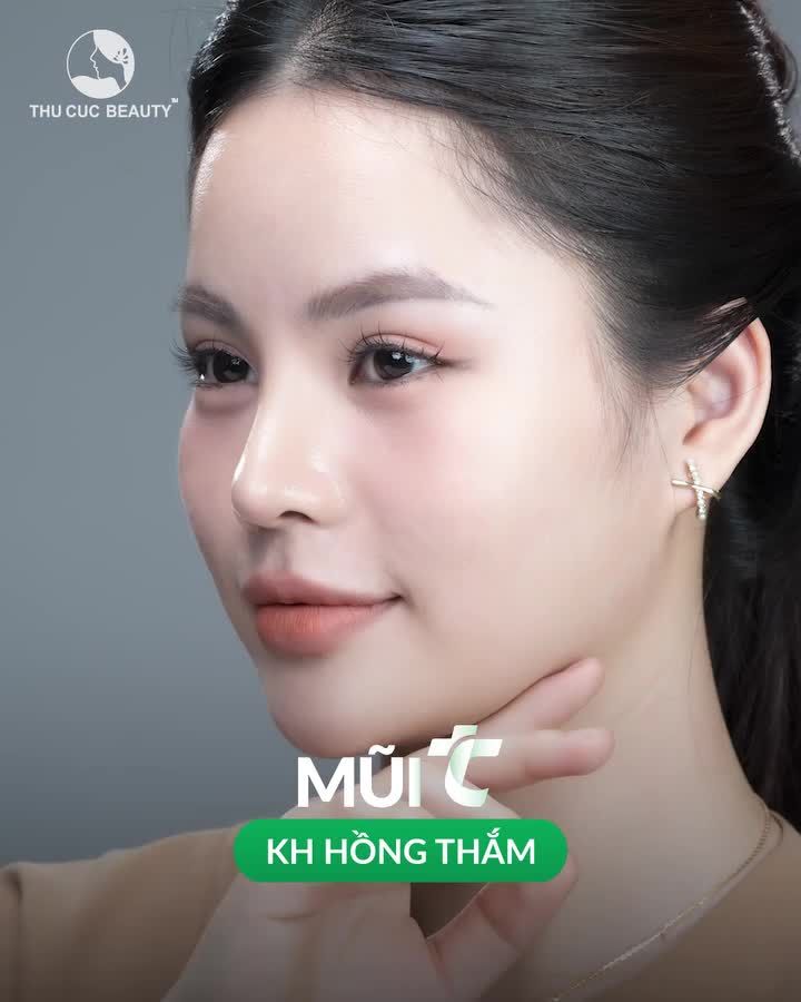 Sở hữu dáng mũi mới đẹp, hài hòa gương mặt vạn người mê cùng hàng ngàn ưu đãi giá sốc