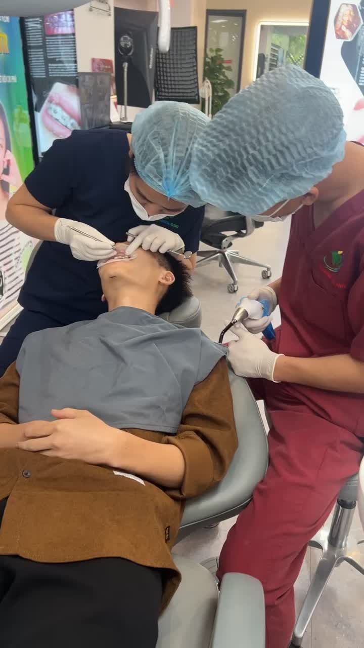Cận cảnh quá trình gắn mắc cài bắt đầu quá trình chỉnh nha gặp tình tạng khớp cắn ngược  của bạn khách hàng đến từ Bắc Giang.