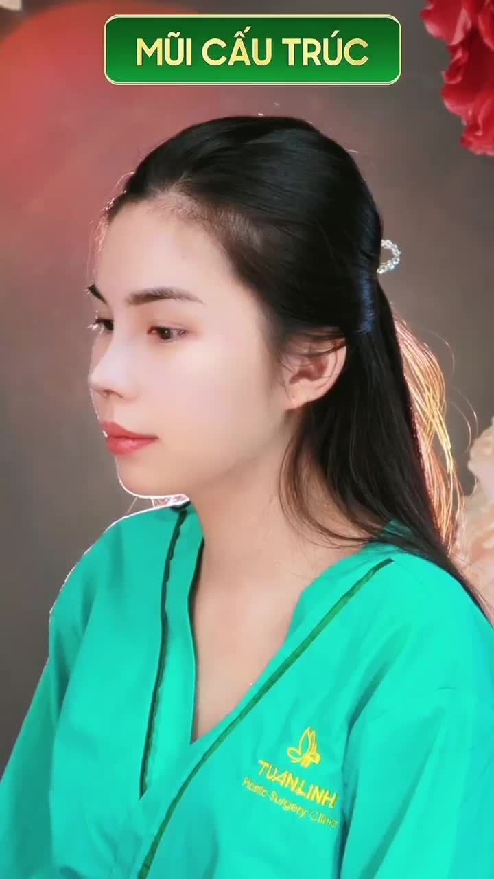 Giao lưu cùng case mũi cấu trúc mới làm xong
