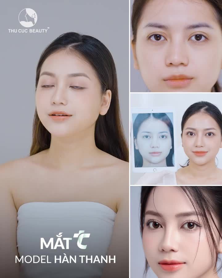 Kiểm chứng nếp mí tự nhiên của Model Hàn Thanh qua video dưới đây