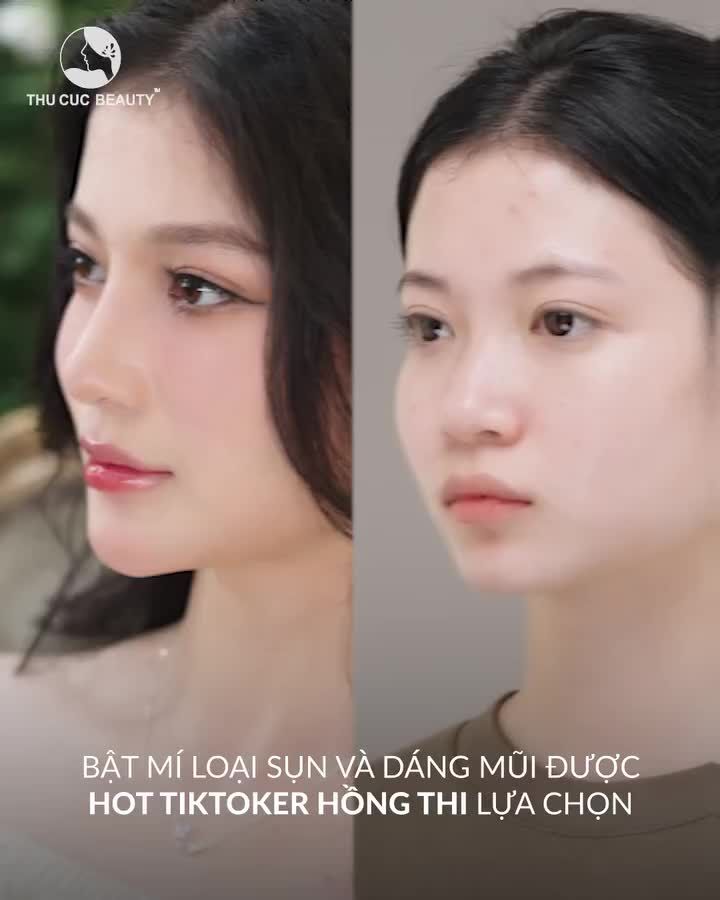 Đến TC Nhan sắc thăng hạng sau nâng mũi là có