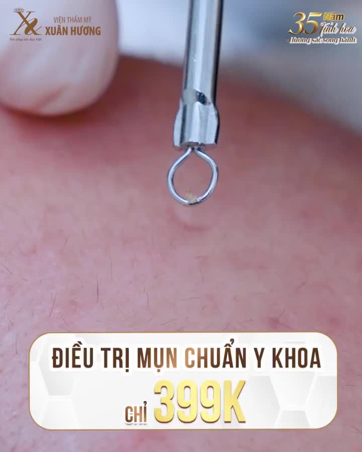 Gạt bỏ nỗi lo về mụn khi tới VTM Xuân Hương chỉ với 399K