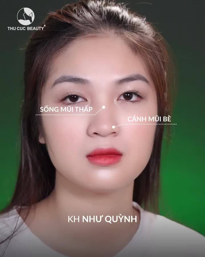 Lo lắng "mũi mọc từ trán" Đến ngay Thu Cúc để Bác sĩ trực tiếp tư vấn đưa ra giải pháp phù hợp