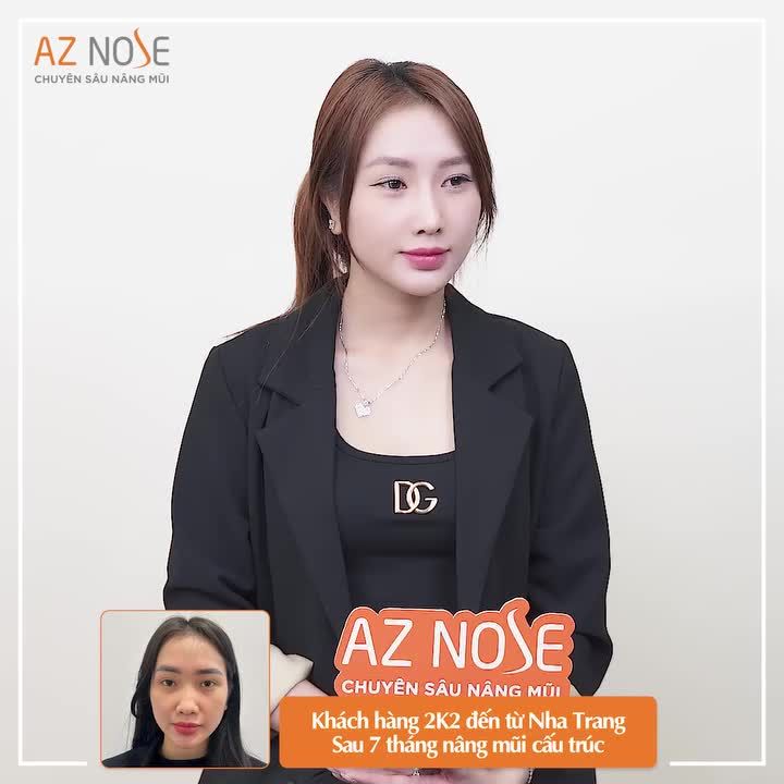 Trải nghiệm nâng mũi "đáng nhớ" của Freelancer 2K2 đến từ NhaTrang