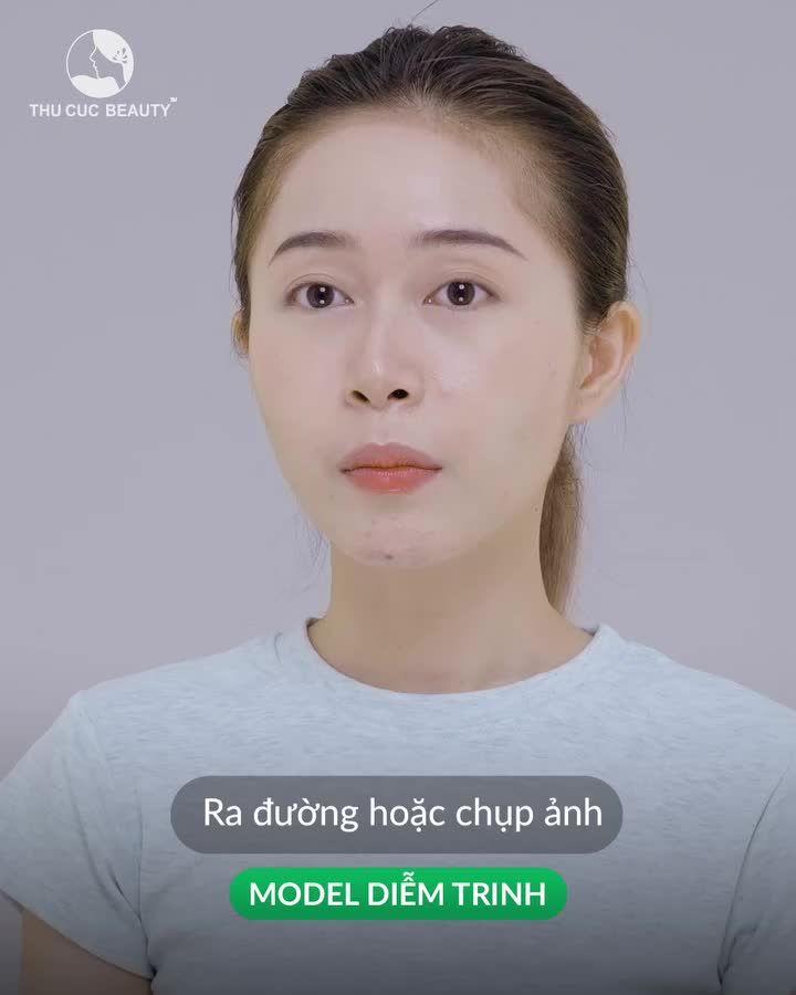 Nóng hơn mùa hè chỉ có thể là giá cắt mí tại Thu Cúc