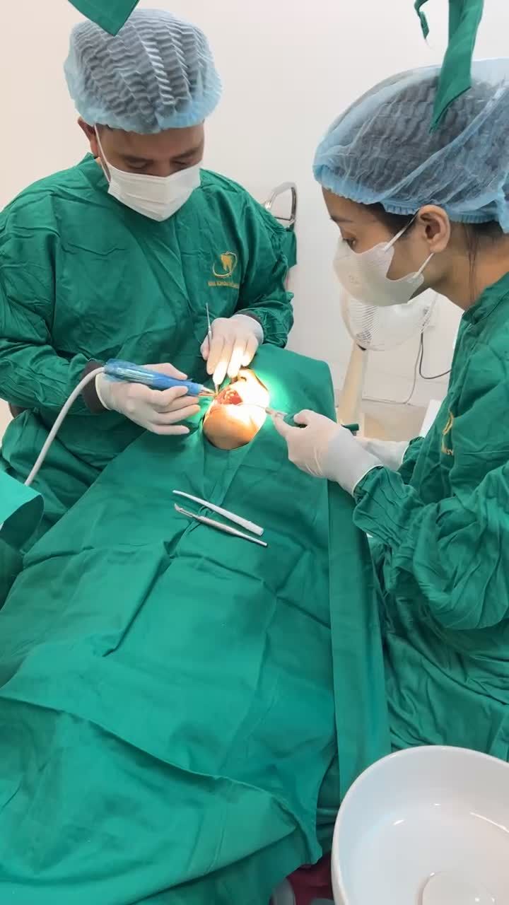 Cận cảnh quá trình trồng răng implant  khôi phục vị trí mất răng hàm cho anh Dương tại Nha khoa Thùy Anh Bắc Giang.
