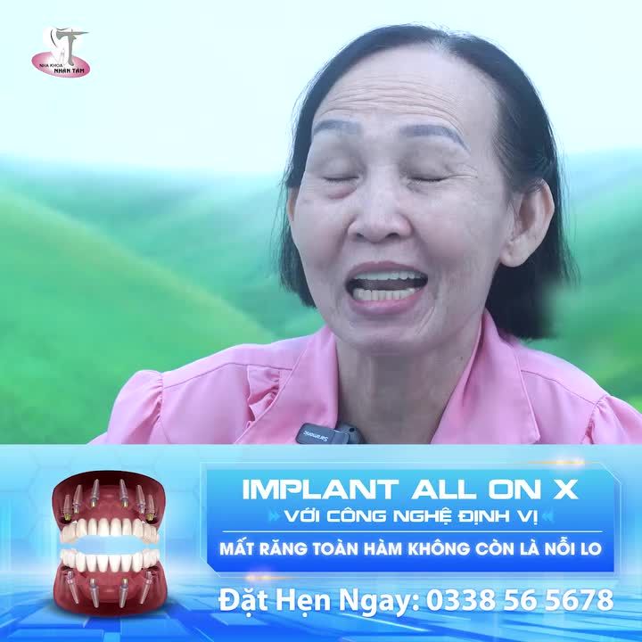 Trồng răng Implant như đi Spa tại Nha Khoa Nhân Tâm
