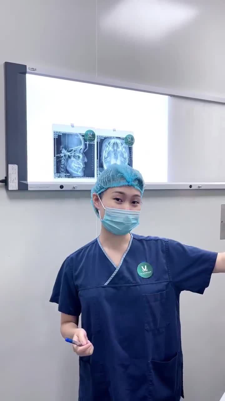 Ca phẫu thuật hạ gò má + gọt hàm đang được ekip Dr. Minh Phạm thực hiện