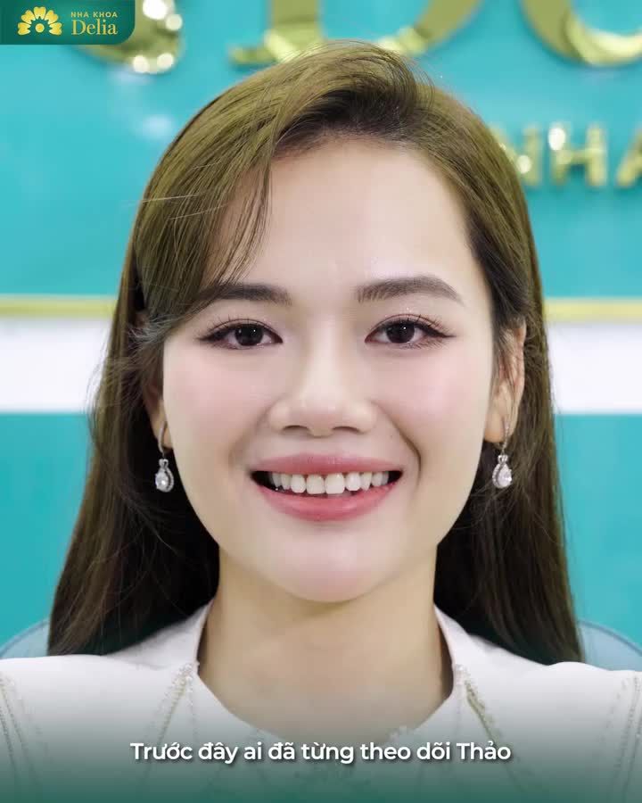 MÀU RĂNG Ố VÀNG KHUÔN RĂNG KHÔNG ĐỀU