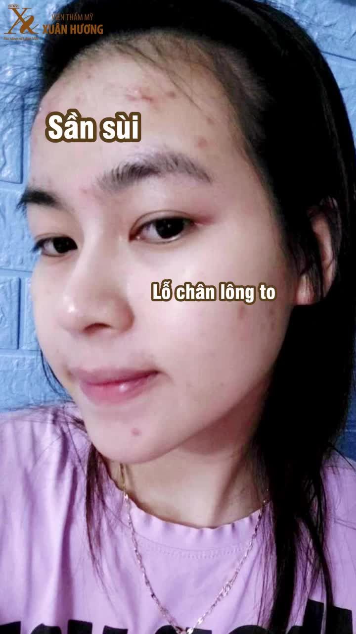 Người thật việc thật, khách hàng feedback lại sau liệu trình trẻ hóa Revive Cell