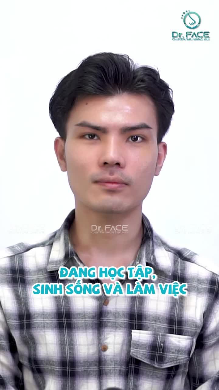 PHÁI MẠNH nâng mũi có bị MẤT NAM TÍNH?