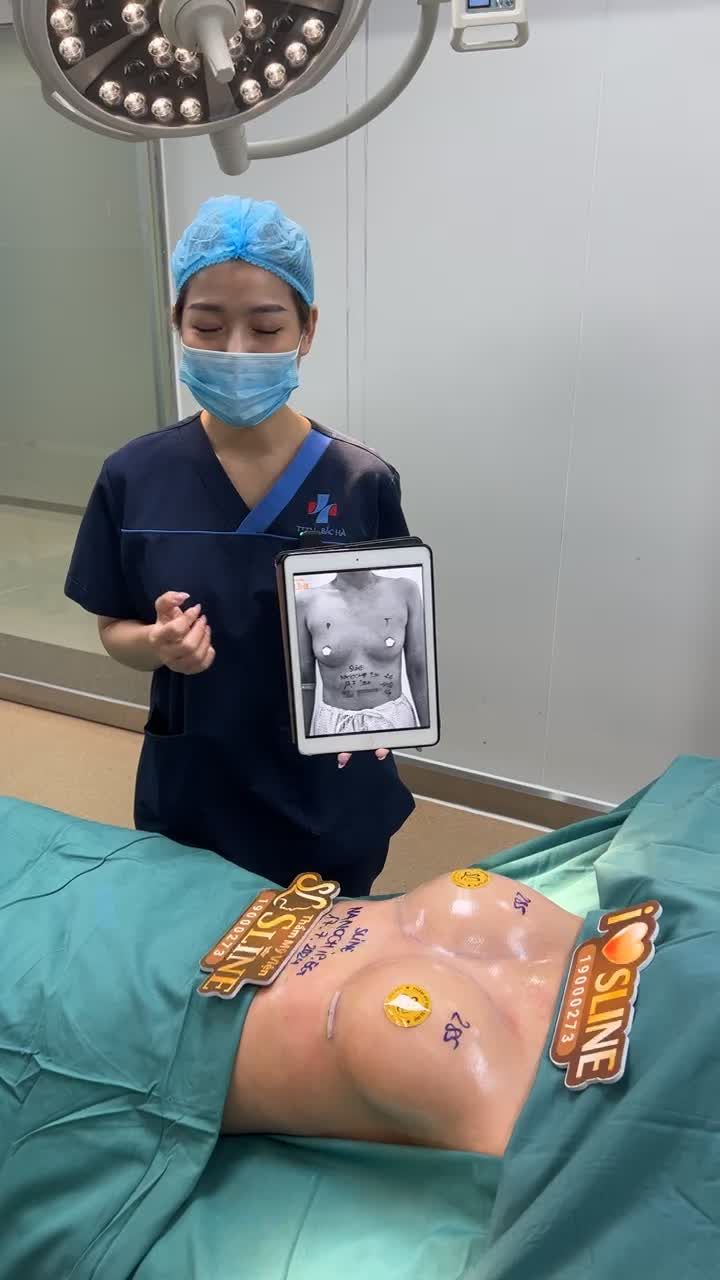 THAY ĐỔI VÒNG 1 TEO LÉP SAU SINH CON