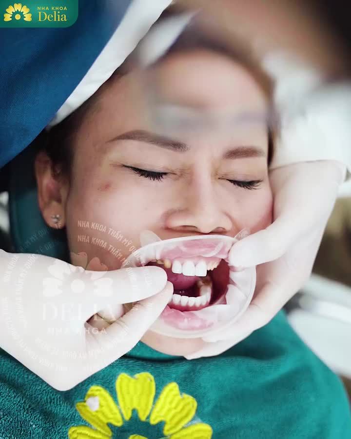 Bác sĩ quyết định đến 80% thành công của 1 ca Làm Răng Sứ