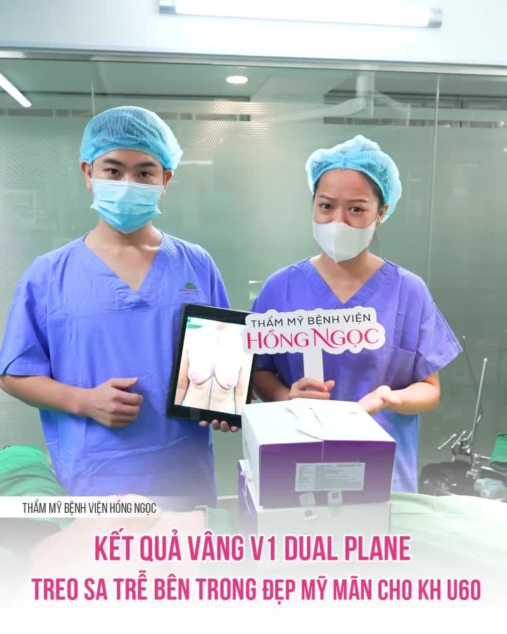 KẾT QUẢ NÂNG V1 DUAL PLANE TREO SA TRỄ  KHÔNG SẸO ĐẸP MỸ MÃN CHO CHỊ KHÁCH U60