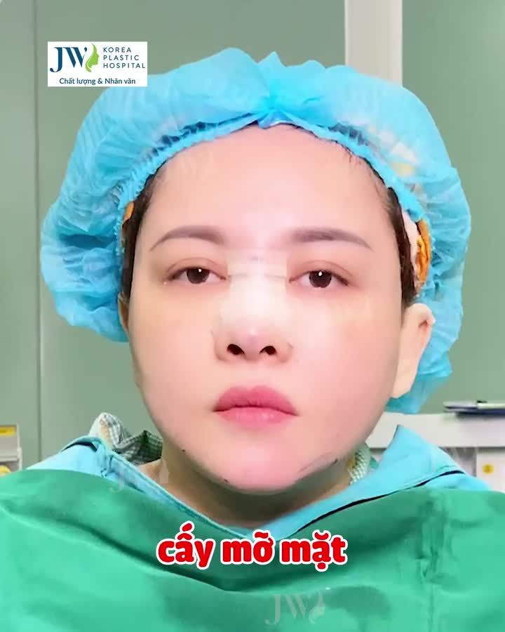 Chị gái Việt kiều U40 MẶT HỐC HÁC bỗng chốc TRẺ 10 TUỔI sau khi CẤY MỠ MẶT BABY FACE tại JW