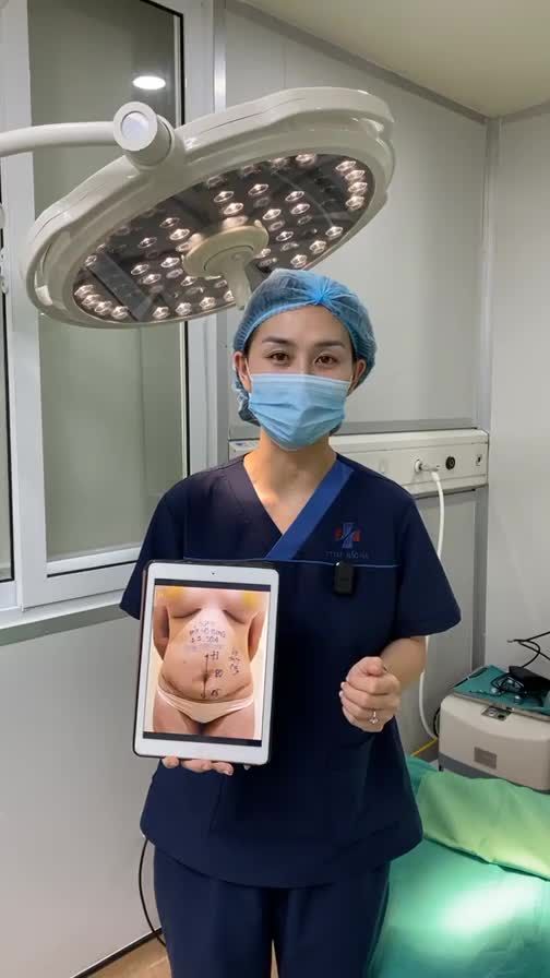 HÚT MỠ BỤNG VỚI VASER LIPO