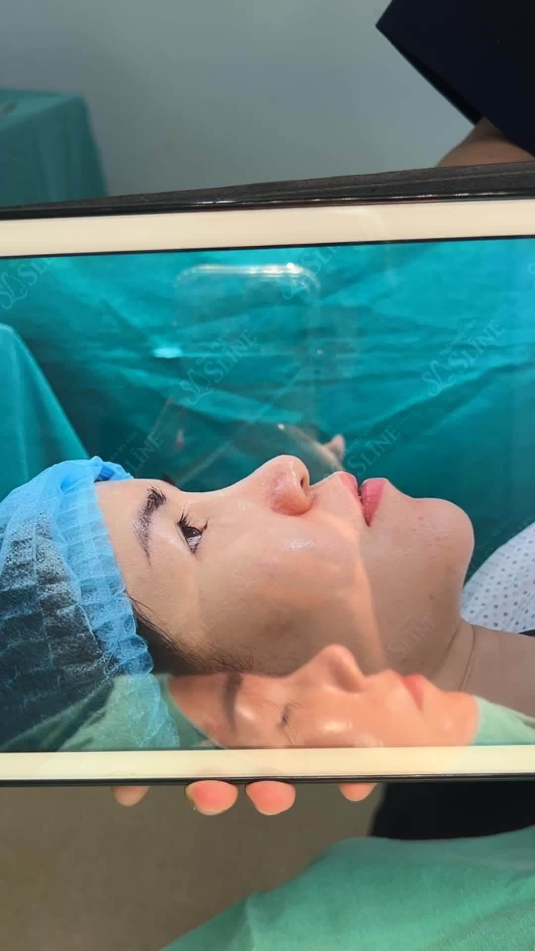 NÂNG MŨI SLINE ĐÃ THAY ĐỔI KHÁCH HÀNG NHƯ THẾ NÀO???