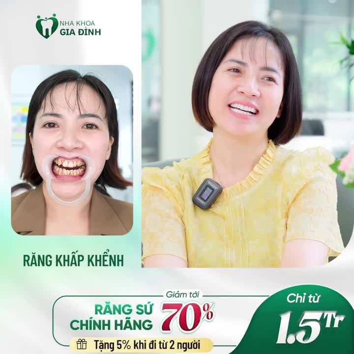 TÂN TRANG NỤ CƯỜI VỚI THẨM MỸ RĂNG SỨ. 9 NGƯỜI LÀM - 10 NGƯỜI KHEN