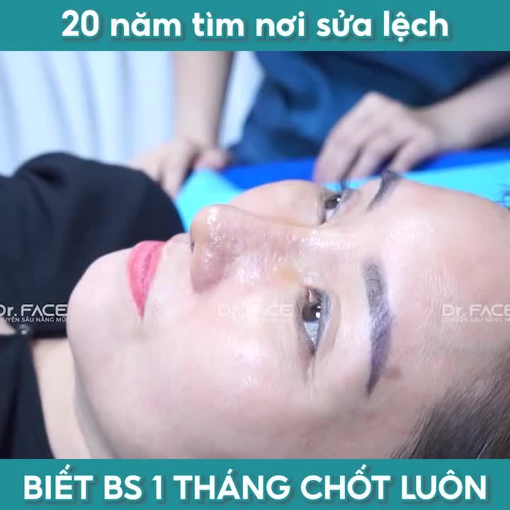 20 Năm Tìm Nơi Sửa Lệch, Biết Bác Sĩ 1 Tháng Chốt Luôn