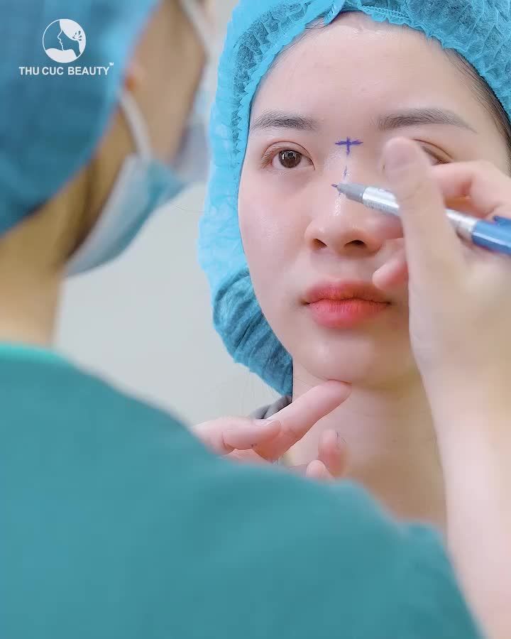 Sau 10 ngày mà mũi đã đẹp đến thế này sao?