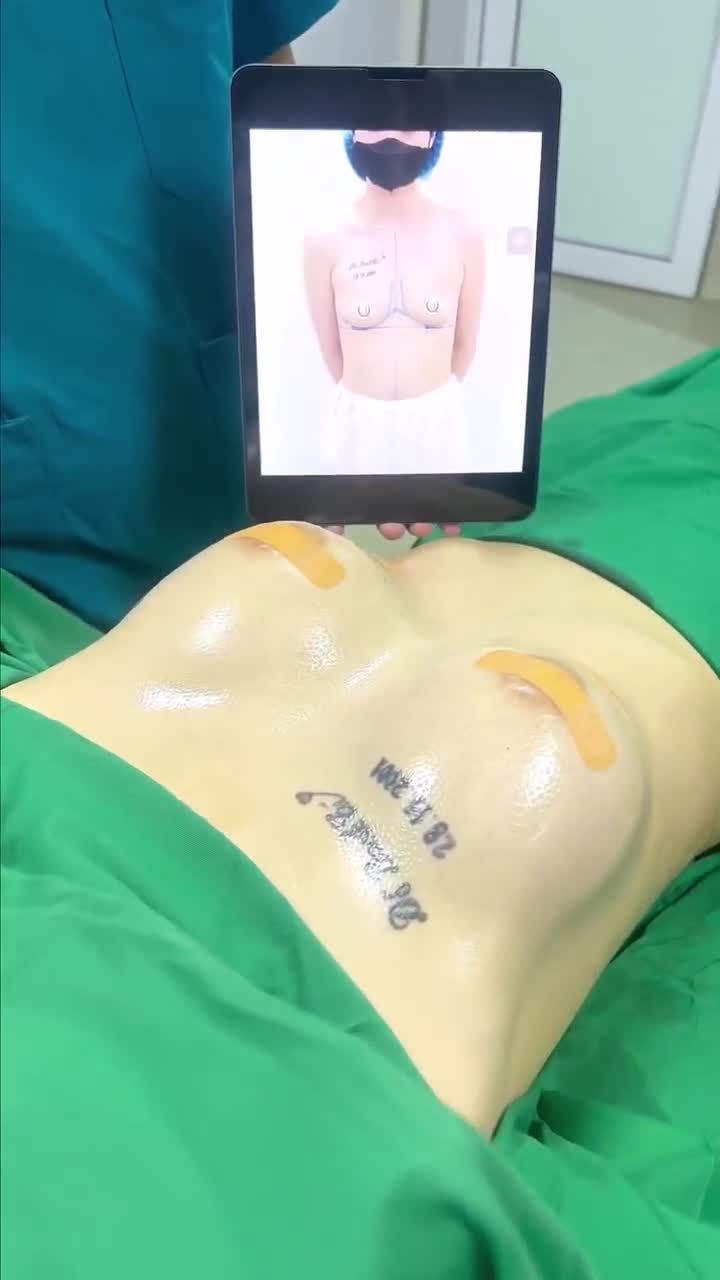 Kết quả nâng cấp vòng 1 cho khách hàng của Dr Vũ Quang