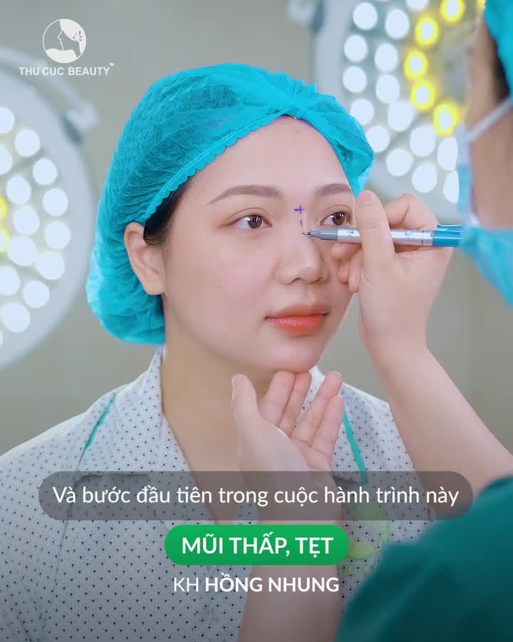 MC Hồng Nhung quyết định nâng mũi để nâng cấp ngoại hình bản thân