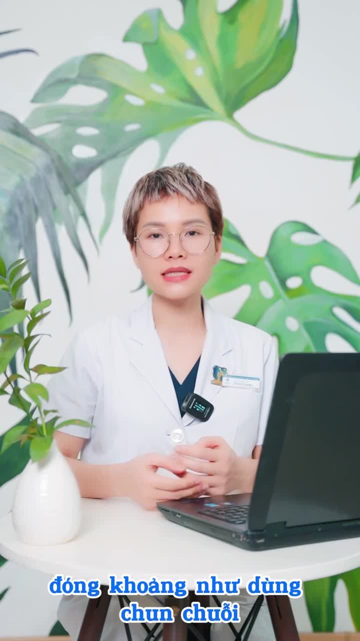 Loop đóng khoảng niềng răng là gì?