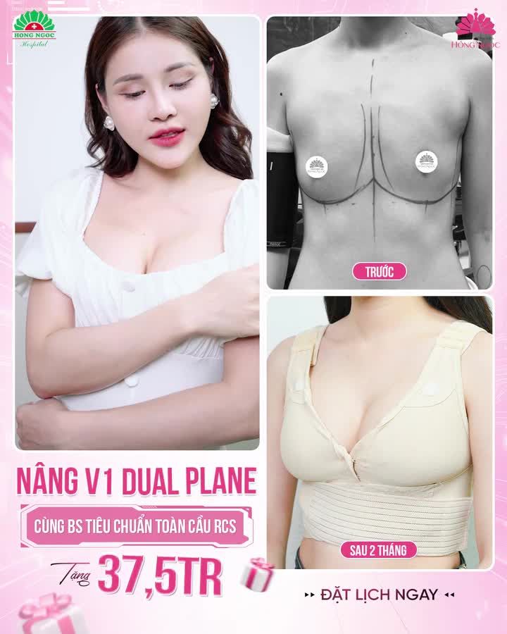 NHẤT ĐỊNH KHÔNG PHẢI GIẤC MƠ - V1 CĂNG TRÒN TỰ NHIÊN SAU 2 THÁNG