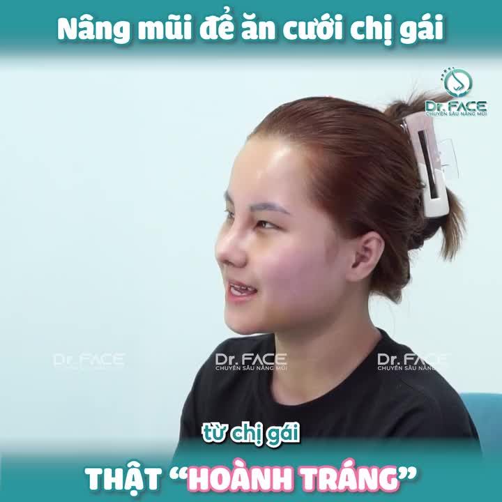 NÂNG MŨI ĐỂ ĂN CƯỚI chị gái thật “HOÀNH TRÁNG”