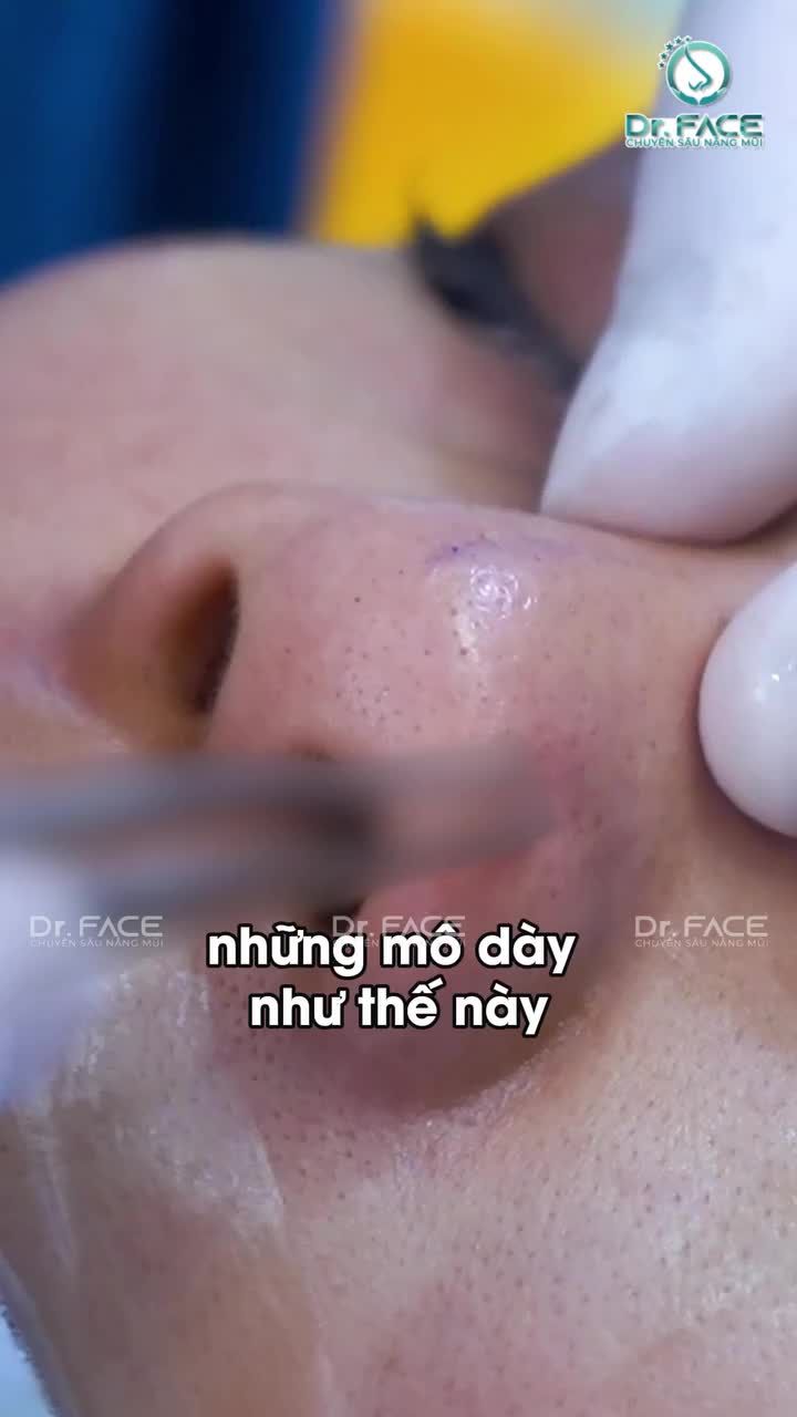 MŨI NÀY coi vậy mà KHÔNG ĐƠN GIẢN