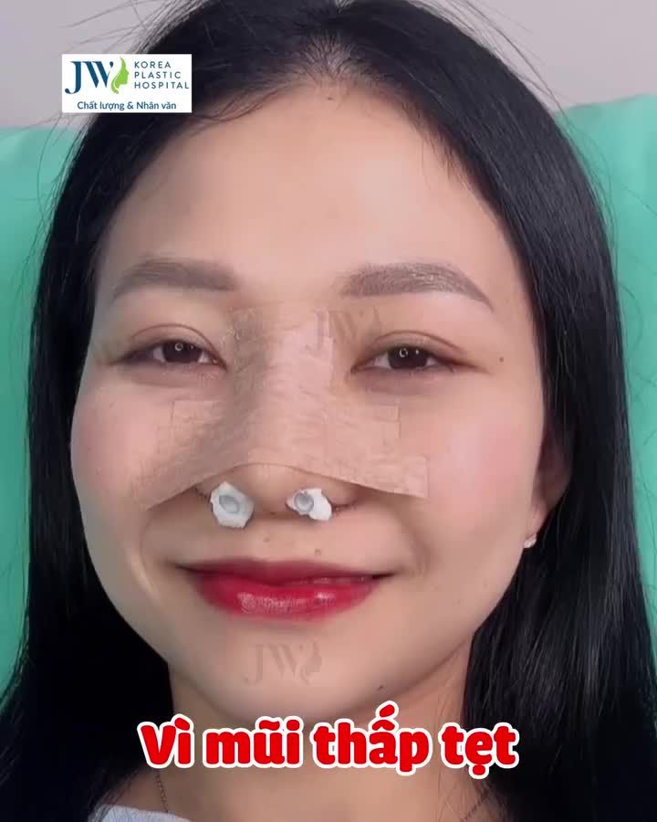 ĐỘ LẠI CHIẾC MŨI ĐẸP MÊ LY CHO EM GÁI BỊ NGƯỜI YÊU CHIA TAY VÌ MŨI TẸT