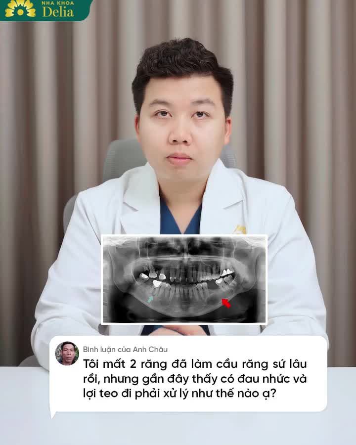 BẬT MÍ CÁCH XỬ LÝ CẦU RĂNG SỨ HỎNG