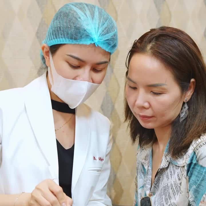 TIÊM FILLER CẰM