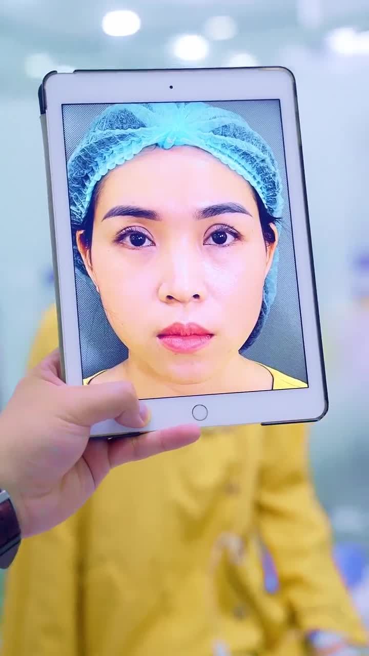 Mí trợn, đính cơ nâng mi sâu thì Dr Hải Lê sẽ giải quyết thế nào? Cùng đón xem!