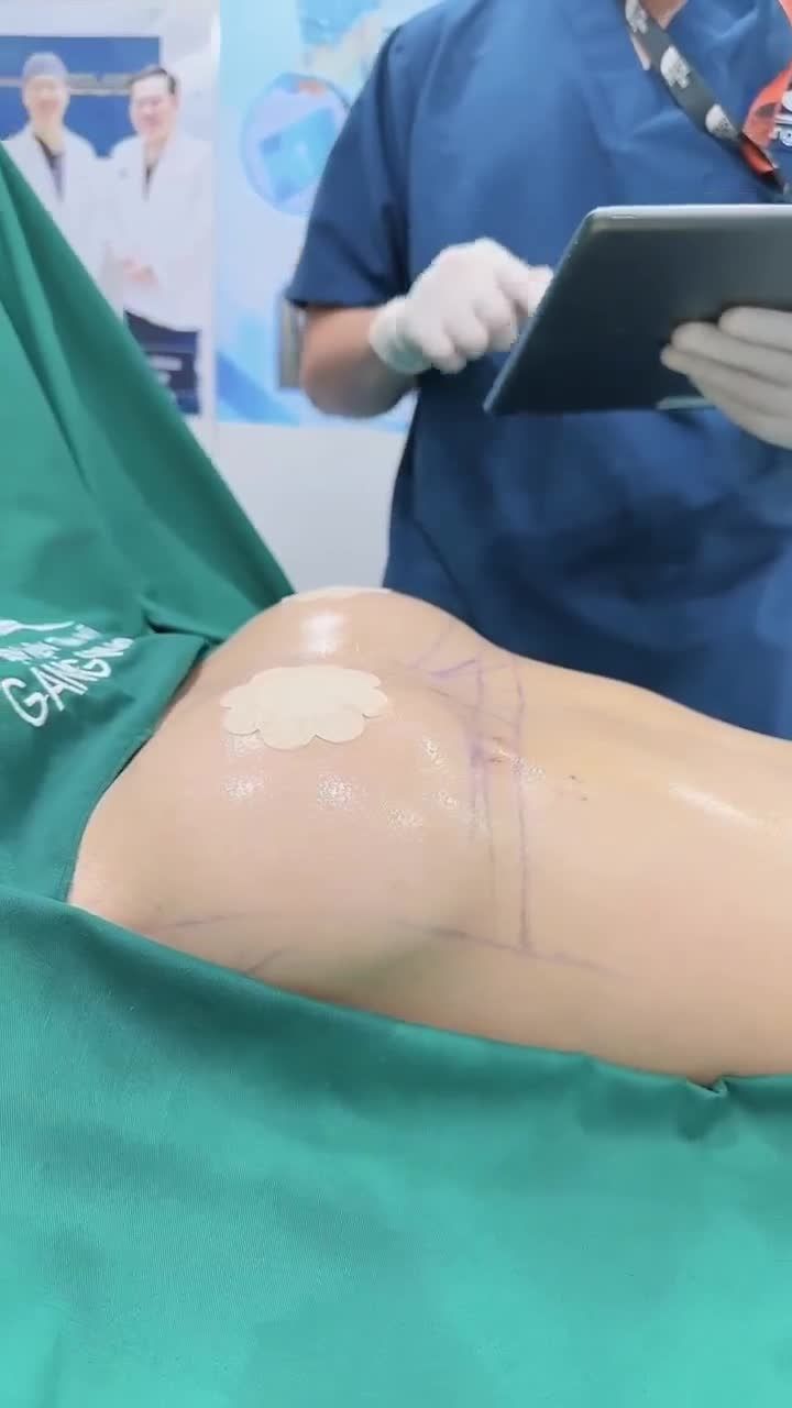 NÂNG CẤP LẠI VÒNG 1 SIÊU NÓNG BỎNG CHO CHỊ KHÁCH HÀNG VIP TẠI BVTM GANGWHOO