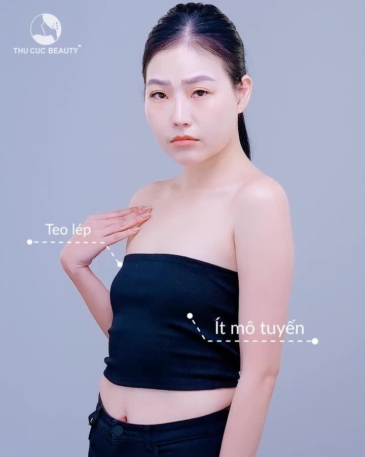Thành công thay đổi diện mạo chỉ nhờ nâng cấp V1?
