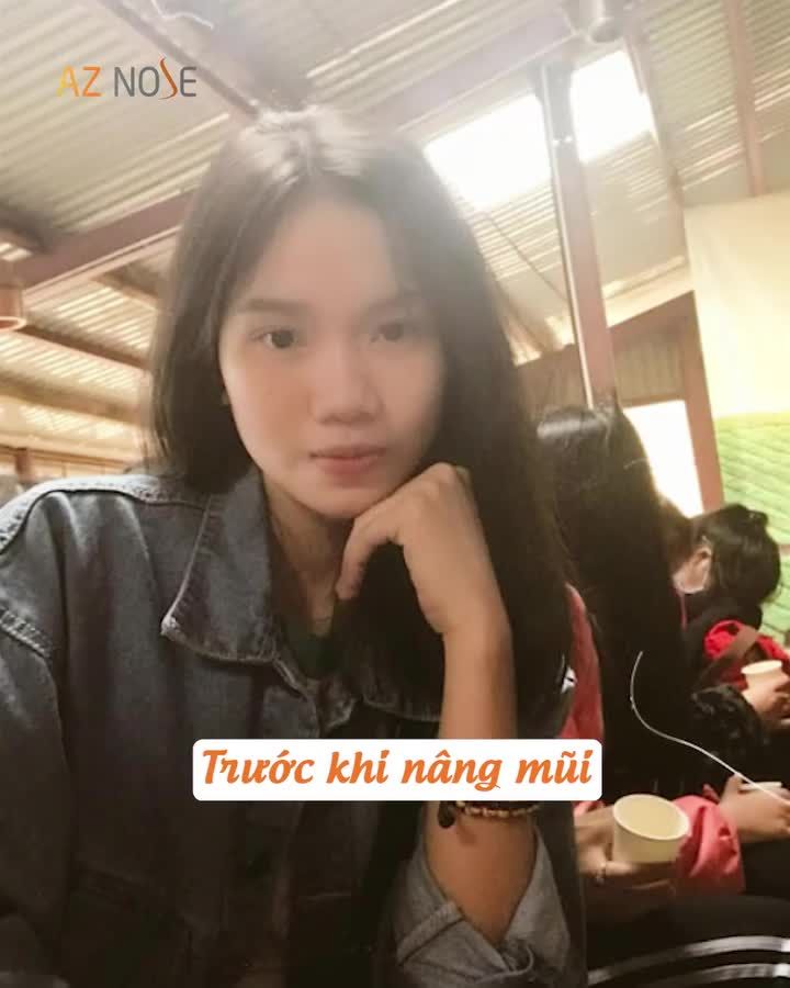 Sau nhiều lần bị "từ chối", nữ MC GenZ chọn nâng mũi để "bứt phá" trong sự nghiệp