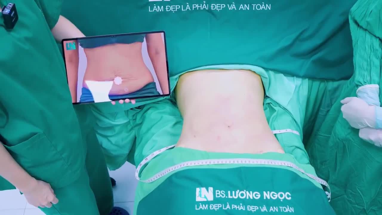 Không còn mỡ bụng tích tụ, lấy lại vòng eo thon gọn quyến rũ chỉ sau 60 phút thực hiện hút mỡ tạo dáng.