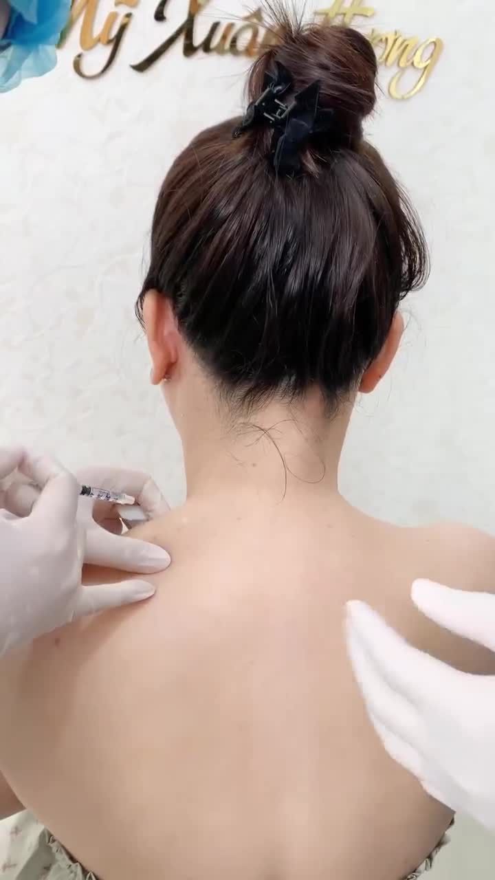 Thon gọn vai u chỉ sau 5 phút