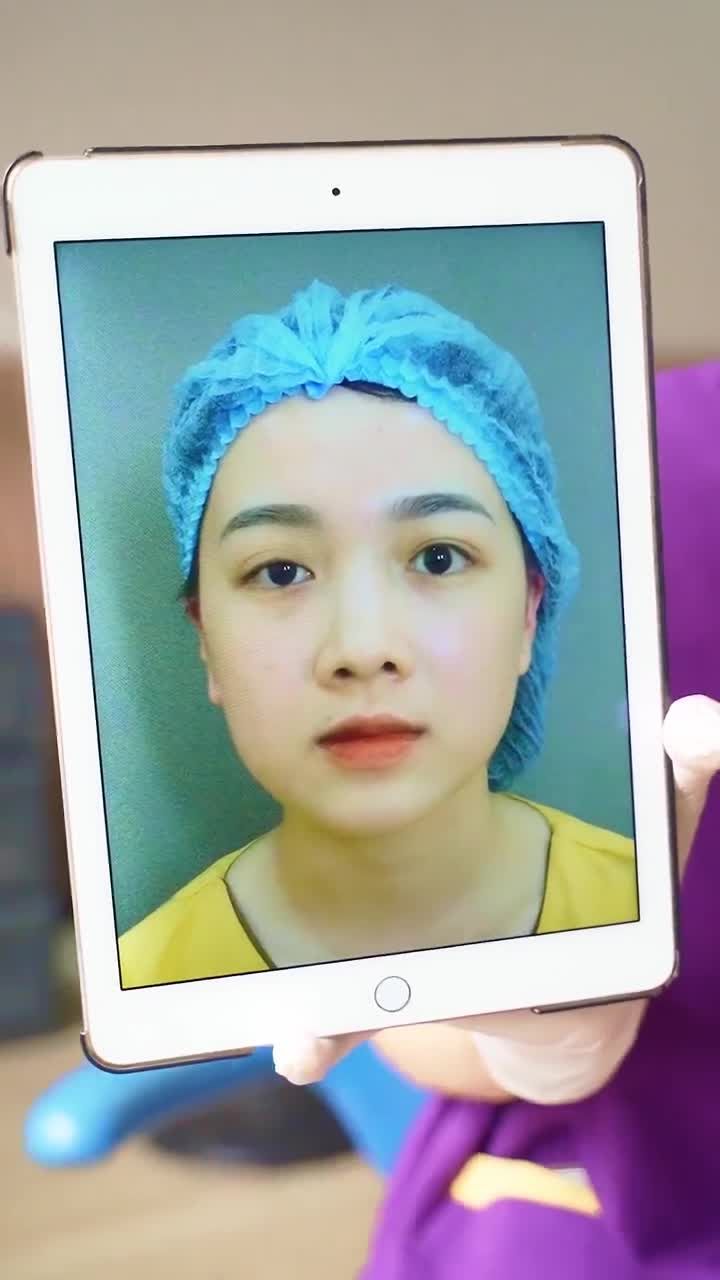 "Giải cứu" thành công đôi mắt nhược cơ bẩm sinh tại Dr.Hải Lê!