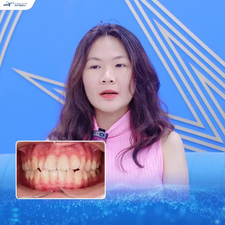 CHỈ 16 THÁNG NIỀNG X-MATRIX, LẤY LẠI TỰ TIN ĐÃ ĐÁNH MẤT TRONG HƠN 20 NĂM
