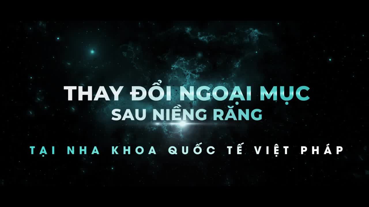 TOP 5 CA NIỀNG RĂNG HÔ THAY ĐỔI NGOẠN MỤC